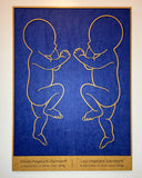 Fødselsbillede m. 2 babyer i 1:1 | 66x48cm | Flere varianter og farver
