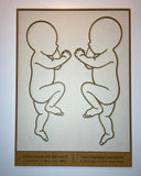 Fødselsbillede m. 2 babyer i 1:1 | 66x48cm | Flere varianter og farver