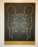 Fødselsbillede m. 2 babyer i 1:1 | 66x48cm | Flere varianter og farver
