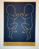 Fødselsbillede m. 2 babyer i 1:1 | 66x48cm | Flere varianter og farver
